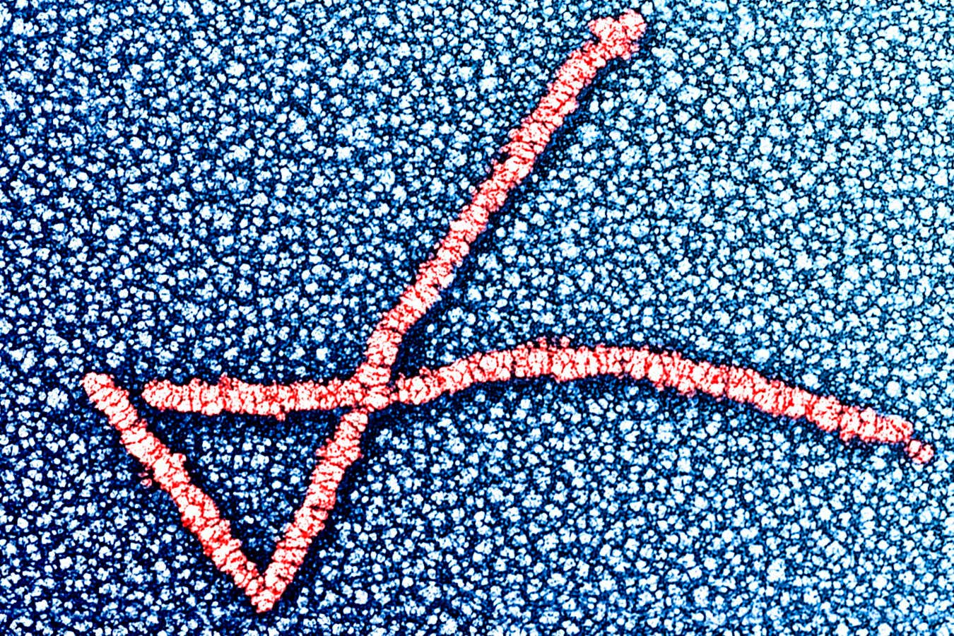 A transmission electron micrograph of the beta-lactoglobulin, the main protein in cow's milk whey, which made up the gel